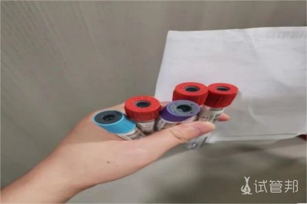 92e42aef3bff6c5587be19fc9dcb3a78.jpg 35岁老阿姨的试管之路笔记