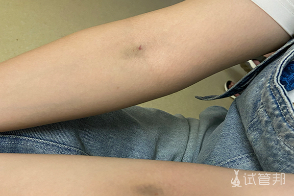 32691526efd93bdbbd41850996c6ed53.jpg 试管婴儿1次成功怀上龙凤胎