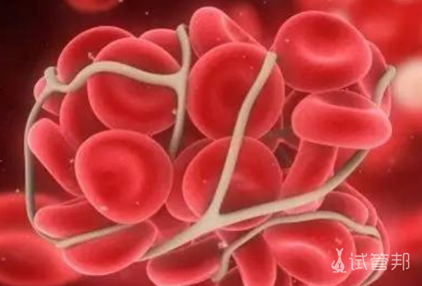 血红蛋白病检查方法是什么