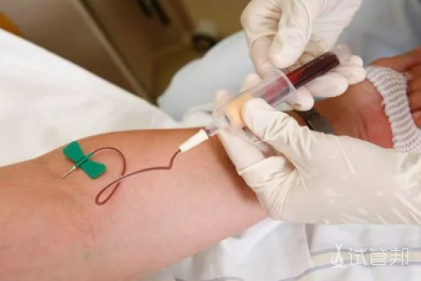 ae631736e7ff88c31673976e5042c257.png 做试管要趁早别等到卵巢早衰才开始