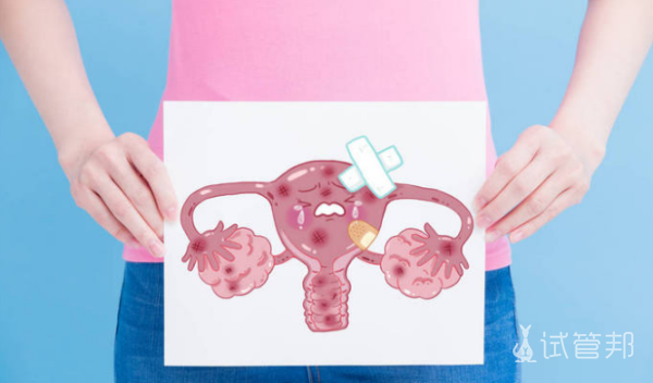 子宫发育异常超声诊断标准