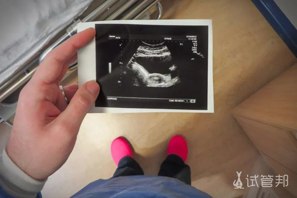 a1cd211816af264f416a70c73f2028f1.jpg 为了要个女儿打了几百针