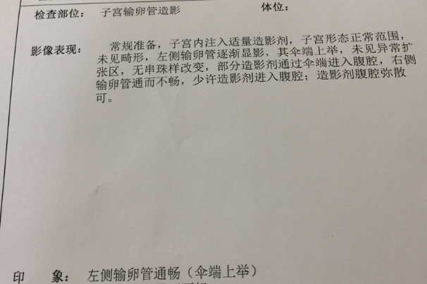 输卵管造影检查需要多久