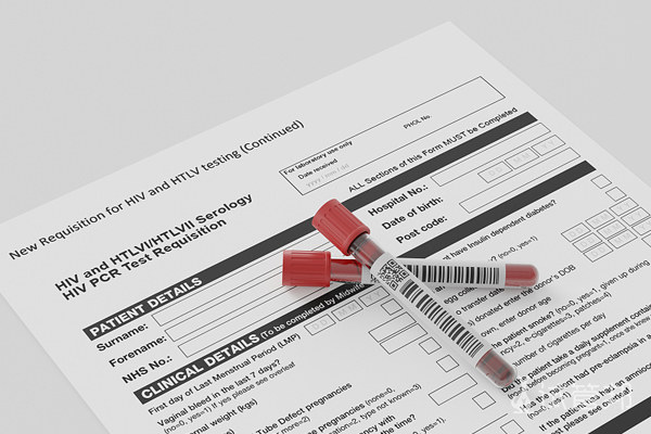 d716ea506f5188e2c159cf29b8fc5c80.jpg 购买精子库精子做试管有哪些流程