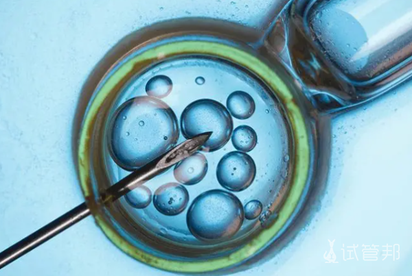胚胎移植手术有哪些步骤
