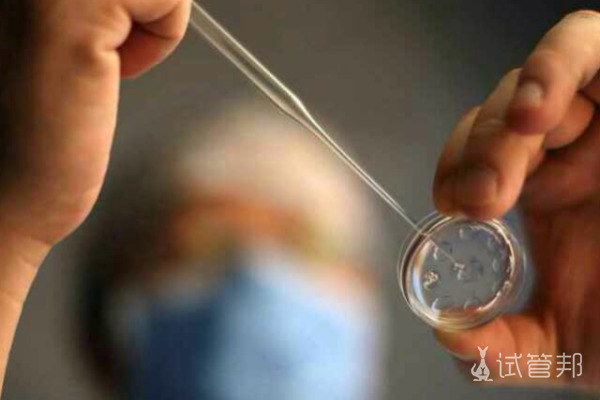 胚胎移植后有哪些注意事项