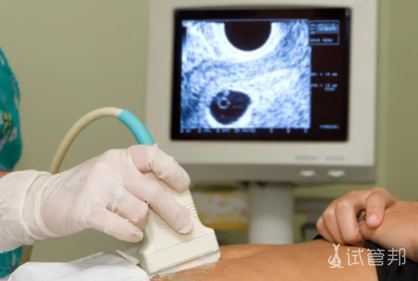 a261b09d5247ff9e6184369302c4fa48.png 卵泡监测怎么看结果