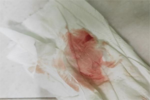 e254d60f8f2b17309a9dc87c553337ef.jpg 着床出血是什么感受