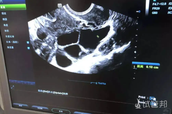 703d662267638f58dc114e96c8f19406.png 终于移植啦希望宝宝们好好的