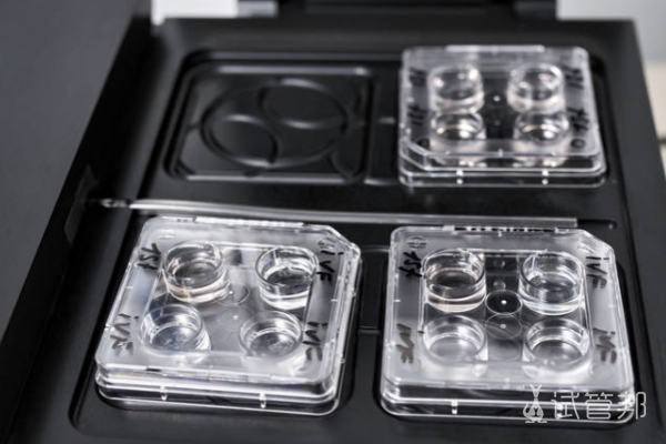 322845842c56282e6220db3b6716694d.png 影响试管婴儿成功率的因素有哪些