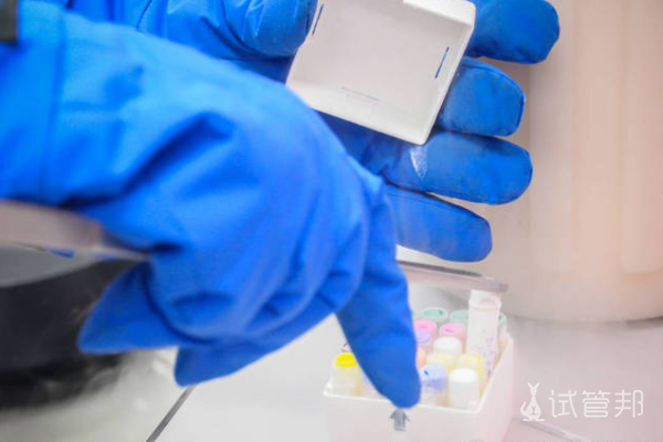 8374b6d654225bad2bfe56fe708219cd.png 试管婴儿成功率受哪些因素影响