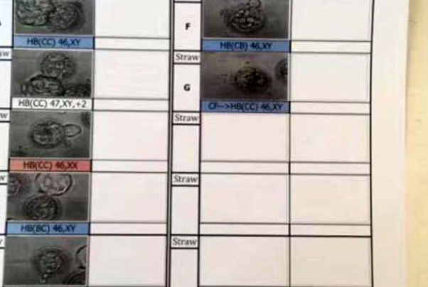 泰国第三代试管婴儿一次成功