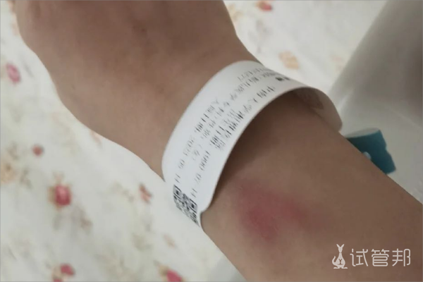 8ffe0093c70332f26225981ebba8c464.png 河北医科大学第四医院试管婴儿取卵