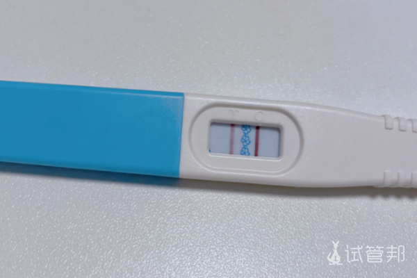 af89424e5e7d14c33b04cfde7215a4ab.png 做试管需要准备什么