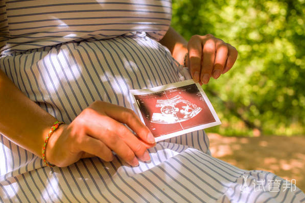 单角子宫怎么安全度过孕期