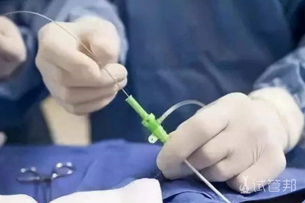 阴道纵隔切除术的手术步骤有哪些