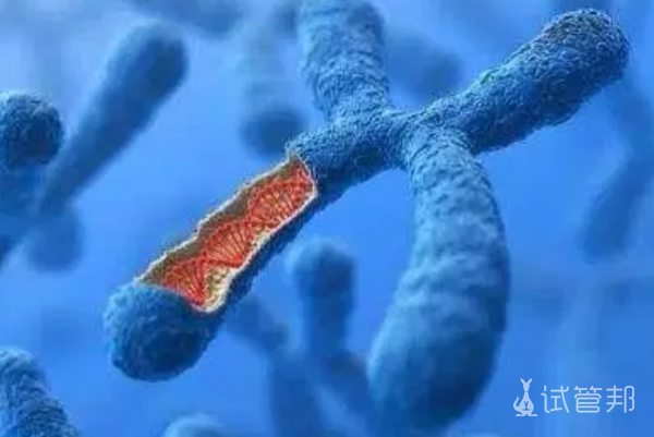 x脆性染色体综合征主要体征是什么