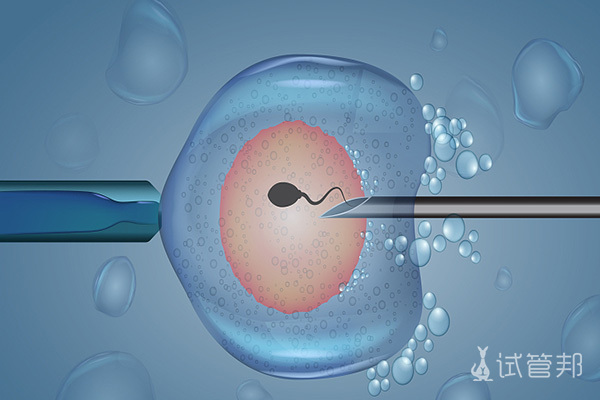 96e4f0e744940843be9180115c852e55.jpg 俄罗斯试管婴儿与泰国试管如何选择