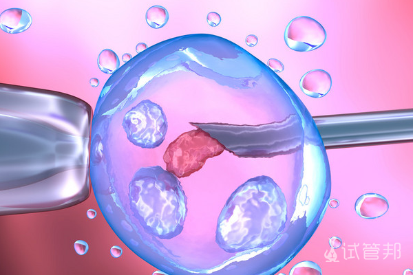 df910bb0e5b99c0f6a1a644486ee869a.png 俄罗斯试管婴儿与泰国试管哪个好