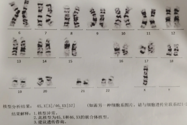 庆幸自己做第三代试管婴儿避免了胚胎染色体异常的情况