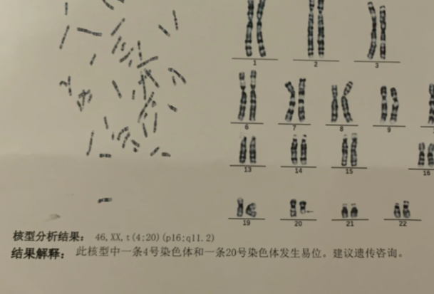 染色体异常姐妹们要去做的检查