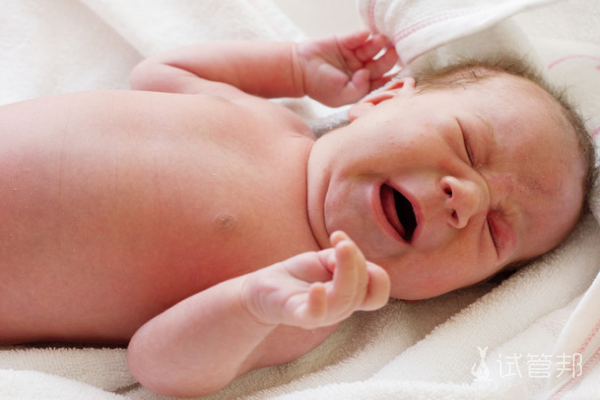 唐氏儿几个月能看出来