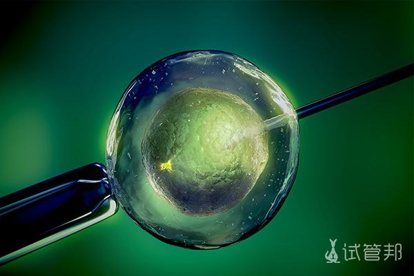 9c1af0f1254455b76b8d1cdc89ccb96a.jpg 俄罗斯去做试管婴儿成功率高吗