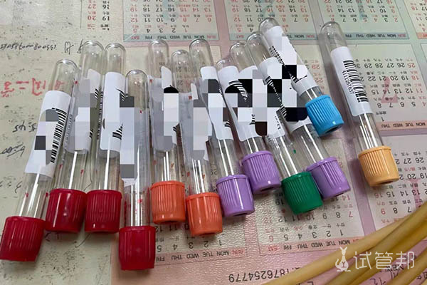 dcf0f655f7f9174acf0959109112af21.jpg 九江市妇幼保健院试管刚开始