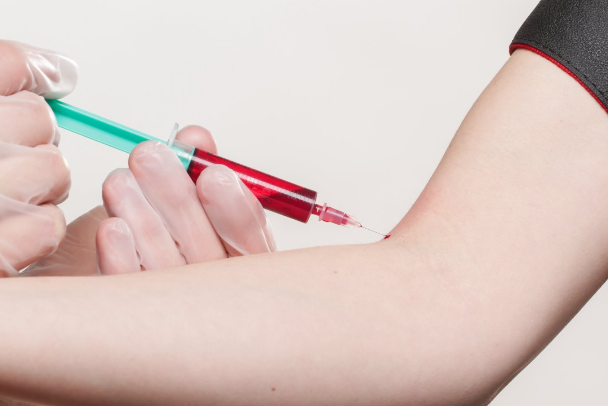 6d982bb42f70f93d2c2782b0b165f6e0.png 多囊性激素六项检查需要多少钱