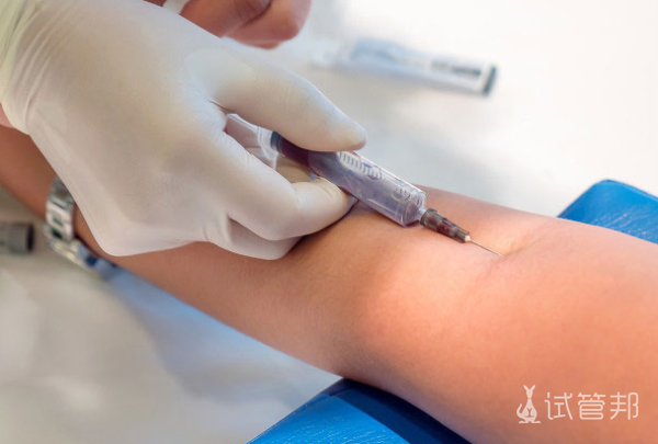 80c0d3b294327c9ceb46589a91b38778.png 性激素六项什么时候检查