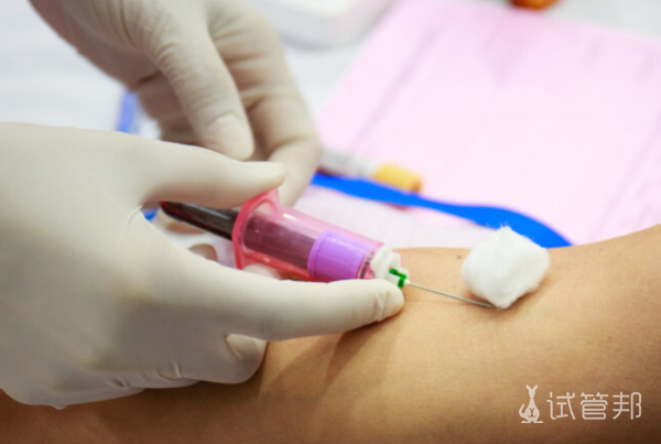 953f1243c6cef4dd5e7ec7955a312686.png 性激素六项检查要空腹吗