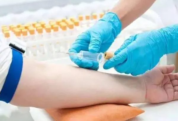 a48463da7fe95cd7963e24e089d52378.png 多囊性激素六项什么时候检查比较好