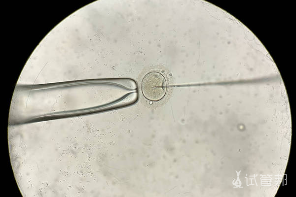 1ba1f3bf83ec7c7cf18720a3593cdf1b.png 第一代试管婴儿费用能报销吗