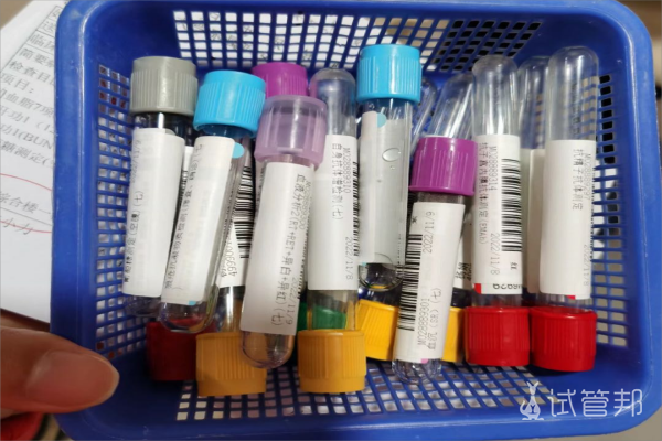 74b8f082bc871a8e6c6b25040840f2c9.png 取卵手术过程是怎样的