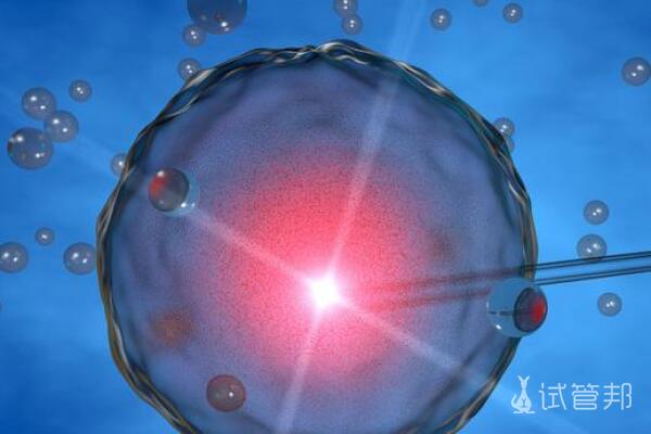 54639eb4084a56ccef00f649b27dc0f4.jpg 第二代试管婴儿是什么原理