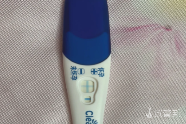 00d6d20cf2c021ba885be02336486fb1.png 做试管婴儿心态到底重不重要