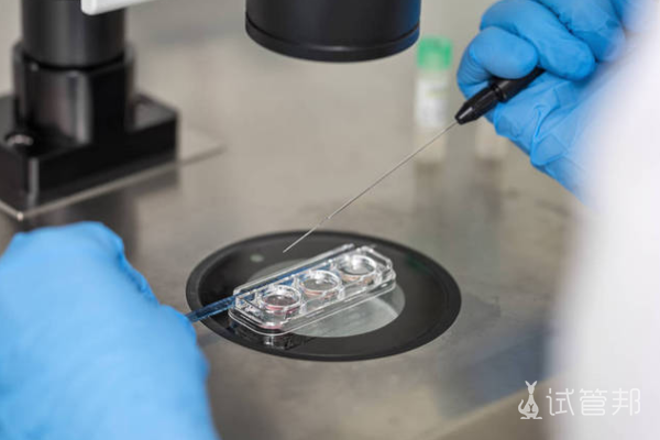 dfacbdca630aebcad9c0760a9f789202.png 试管婴儿囊胚什么时候可以移植