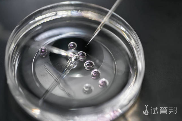 b52473a817f1196e9d7cca8869dff0d5.png 试管婴儿费用能报销吗