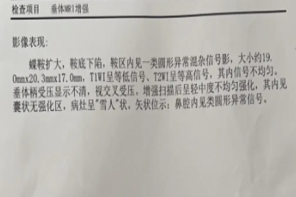 确诊垂体瘤进行手术治疗