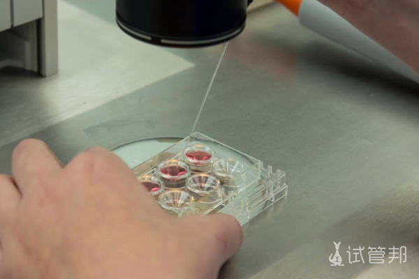 a3293467743520345a409d29e1660641.png 试管婴儿需要多少钱