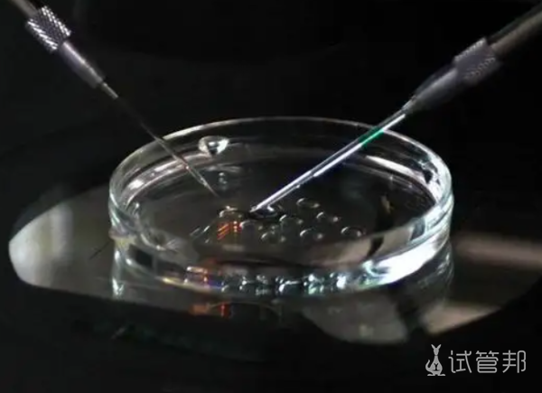 c998d508132b4f4da691dd3e7aea0b8a.png 中山大学附属第一医院试管婴儿怎样