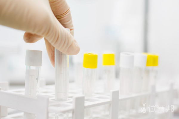 cb2b56aff5db96af8e263c57a646833c.png 广东省妇幼保健院试管婴儿成功率高吗