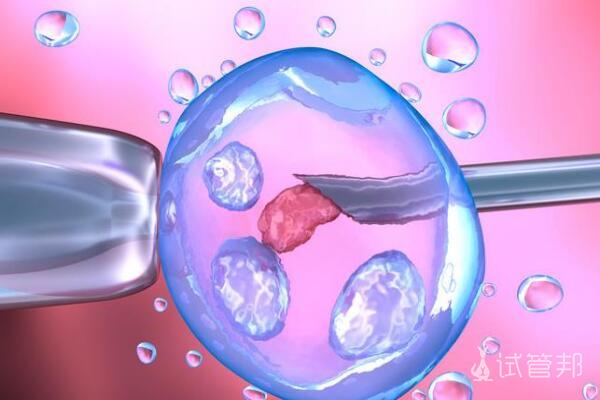 d78b292aae8a195c1f935476dcfd39af.jpg 试管人工周期的费用标准是怎样的