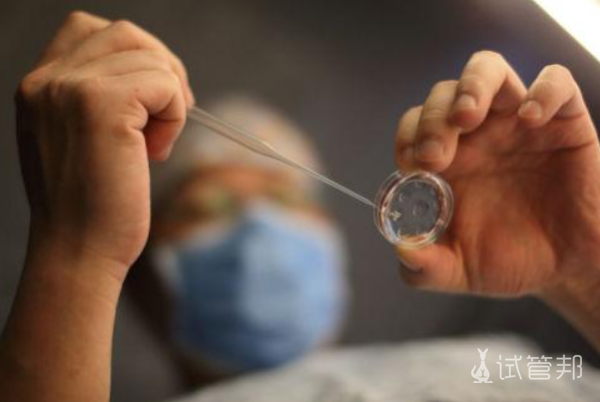 fb5a4fe6bb1ca39e216b1f96f8a92845.png 广州第一人民医院做试管成功率高吗