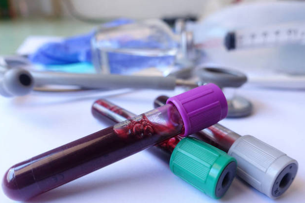 2380bc0e9a2771eb7681206b1bb35fa9.png 免疫检查的作用有哪些