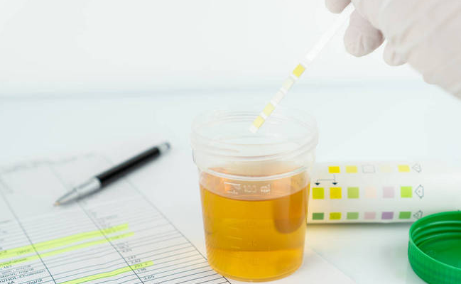 5825175db3793f50cbd2e51f8a7dbb9f.png 试管婴儿检查项目清单