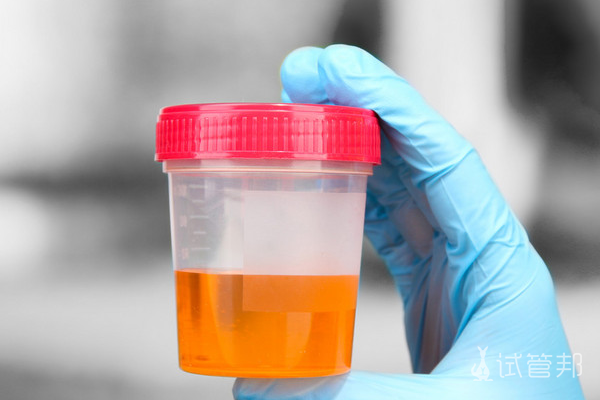 bc3ff1680924c9af35bc802e639b2e3f.png 试管婴儿检查时间安排是怎样的