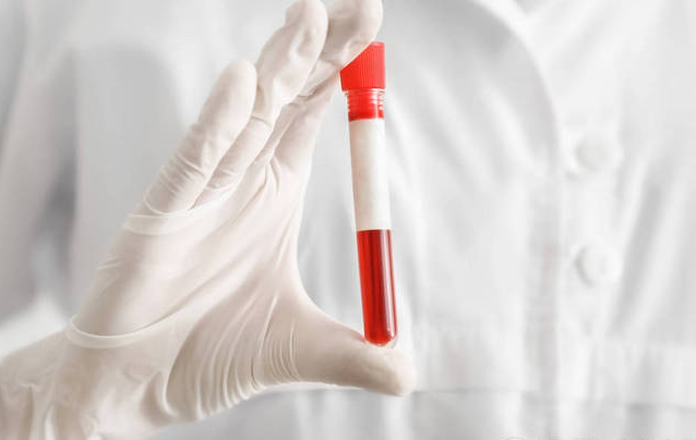 b78c9867991785ac77dfe8396bd41a0a.png 试管婴儿第一次检查是否需要抽血