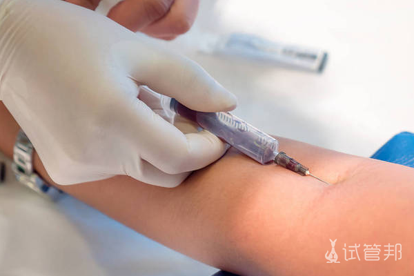 ba9ae28ec3535dd7a60253be945f9f56.png 试管移植前要做什么检查