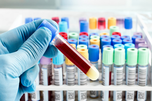 749f69186adce227ea4864081943b10a.png 男性做试管婴儿检查有哪些注意事项